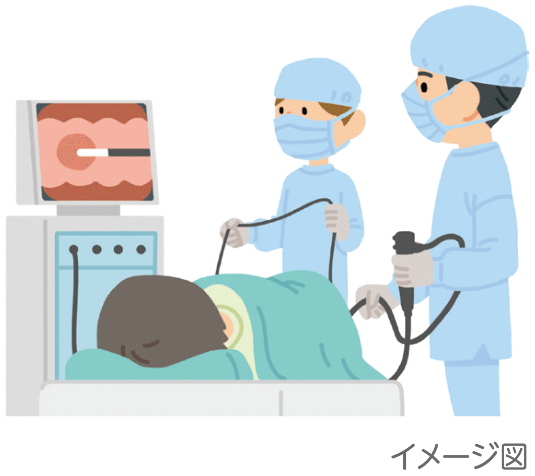 内視鏡治療