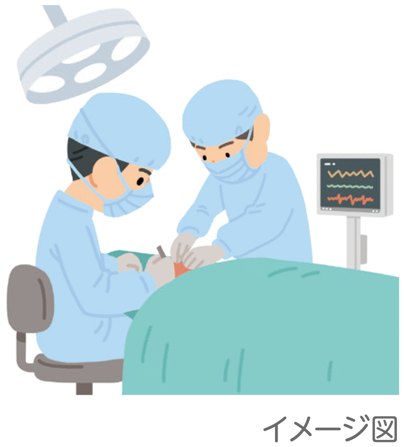 大腸がんの手術のイラスト