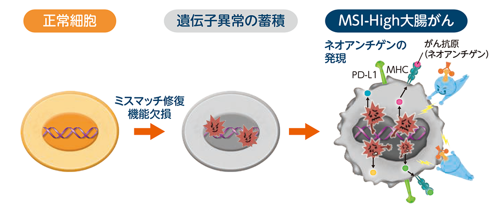 MSI-Highがんとがん免疫療法