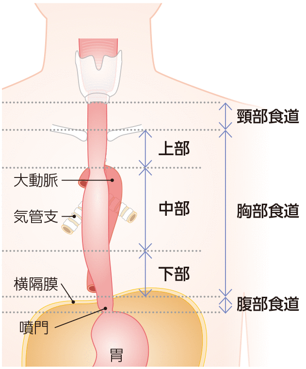 発生部位別の種類