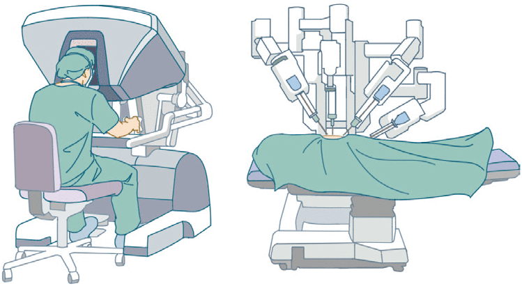 ロボット手術も保険適用に