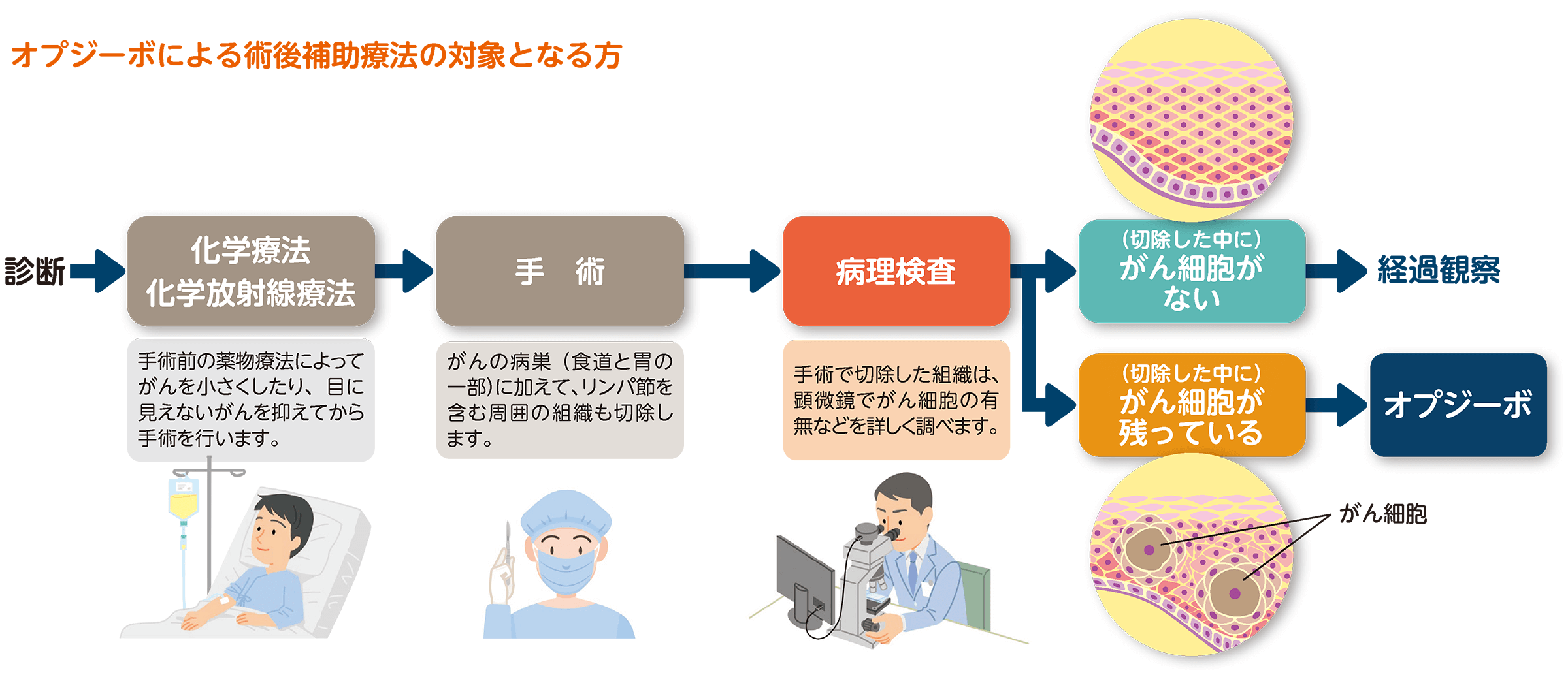 オプジーボによる術後補助療法の対象となる方