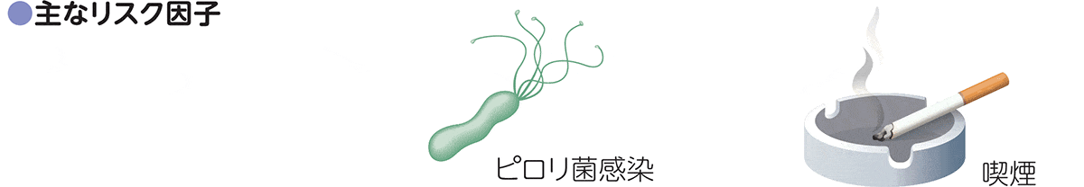 主なリスク因子