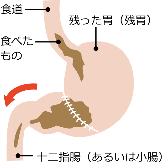胃のイラスト