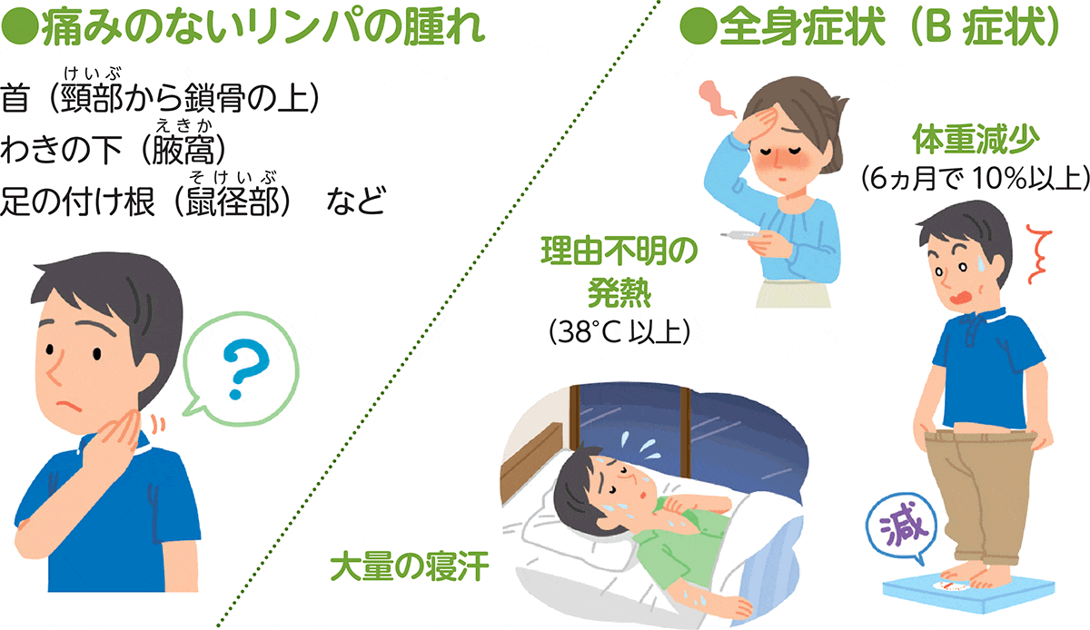 ホジキンリンパ腫の主な症状の図。主な症状は痛みのないリンパの腫れと全身症状（B症状）に分類されます。全身症状には6ヶ月で10%以上の体重減少、38度以上の理由不明の発熱、大量の発汗があります。