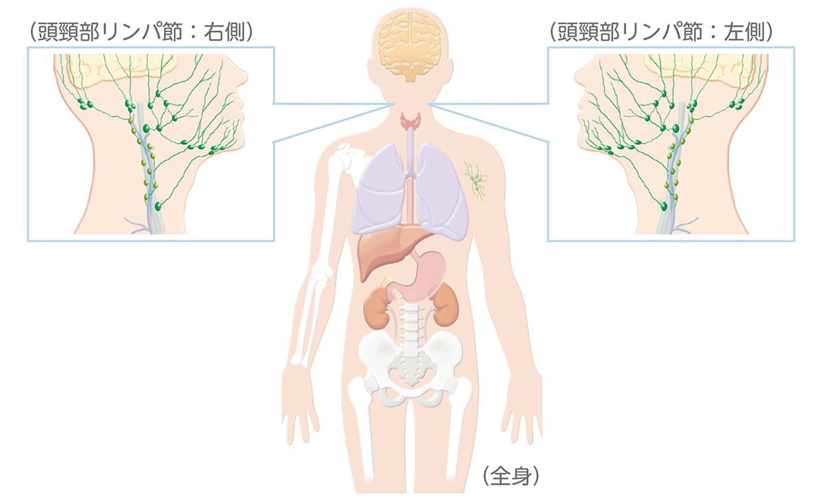 頭頚部リンパ