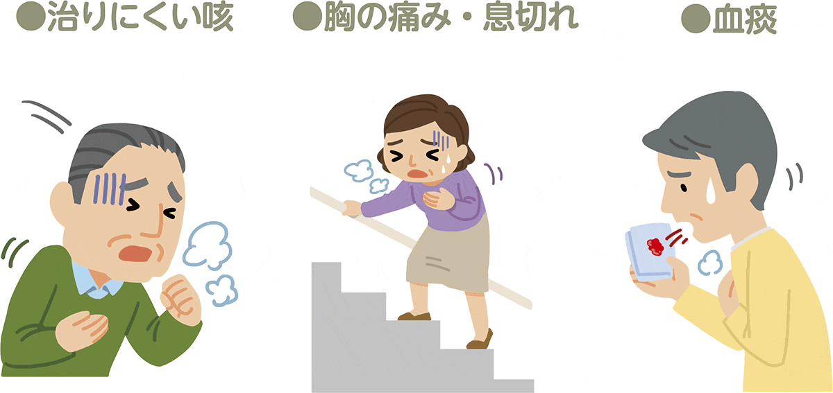 肺がんの主な症状。症状として、治りにくい咳、胸の痛み・息切れ、血痰があります。