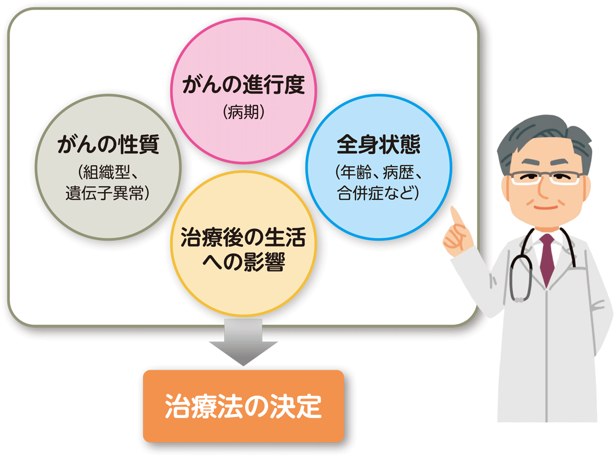 肺がんの治療方針の要素。「がんの進行度（病期）」「がんの種類（組織型）」「全身状態（年齢、病歴、合併症など）」「治療後の生活への影響」から、治療法が決められます。