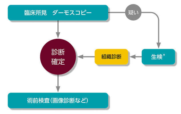 悪性黒色腫の検査・診断のチャート図