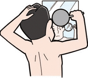 首や頭の後ろ側も鏡を使って観察しましょう。髪の分け目の頭皮もチェックしましょう。