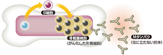異常な形質細胞の働き