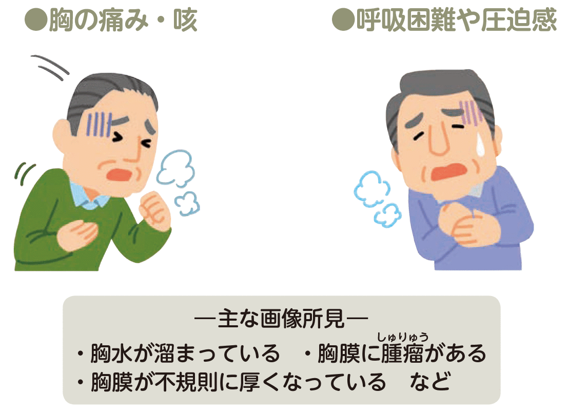 悪性胸膜中皮腫の主な症状