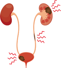 尿路ないのイラスト