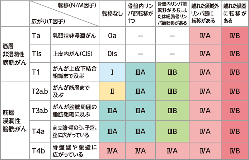 膀胱がんの病期（TNM分類）