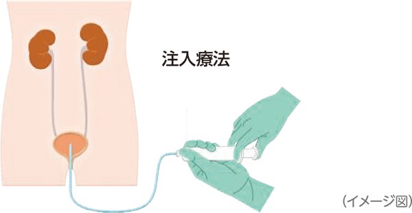 BCG（結核予防のワクチン製剤）