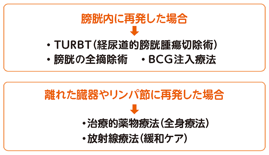 再発した尿路上皮がんの治療法