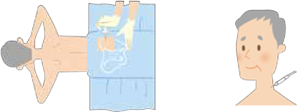 骨髄穿刺・生検/リンパ節生検方法