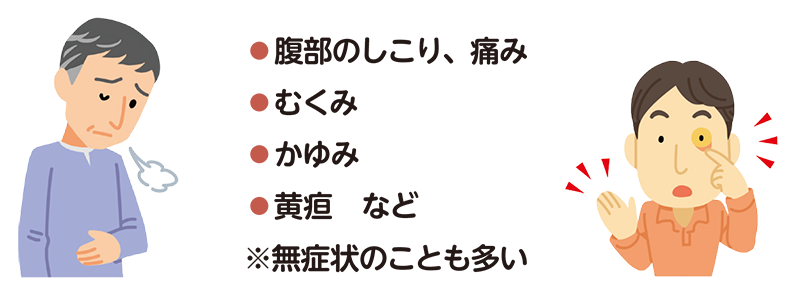 肝細胞がんの主な症状