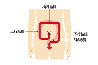下痢サムネイル