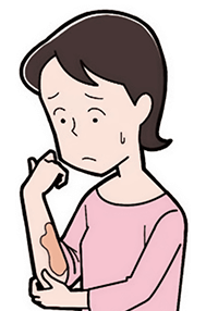 皮膚の表面がただれたり、じゅくじゅくしたりする