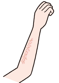 3週目頃～・皮膚の乾燥