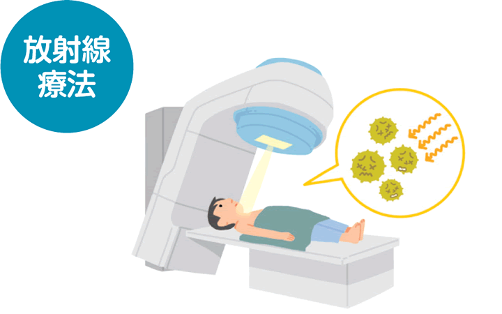 放射線療法のイラスト