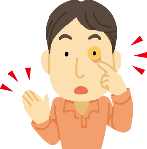 皮膚や白目が黄色くなる患者さんのイラスト