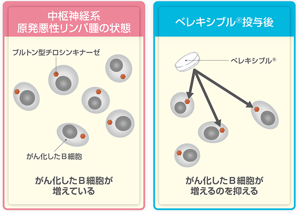 ベレキシブルのPCNSLに対する働き